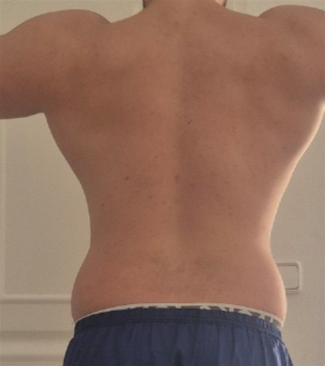 Álvaro, ahora: 86 kg