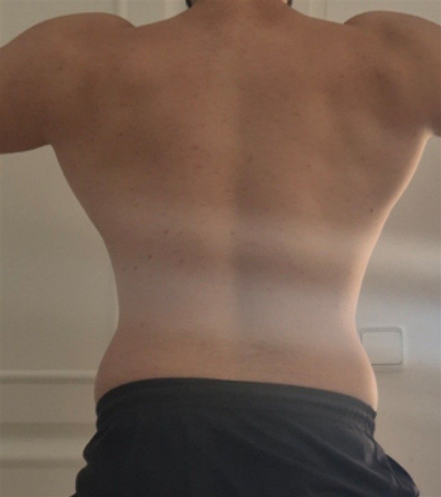 Álvaro, antes: 95 kg